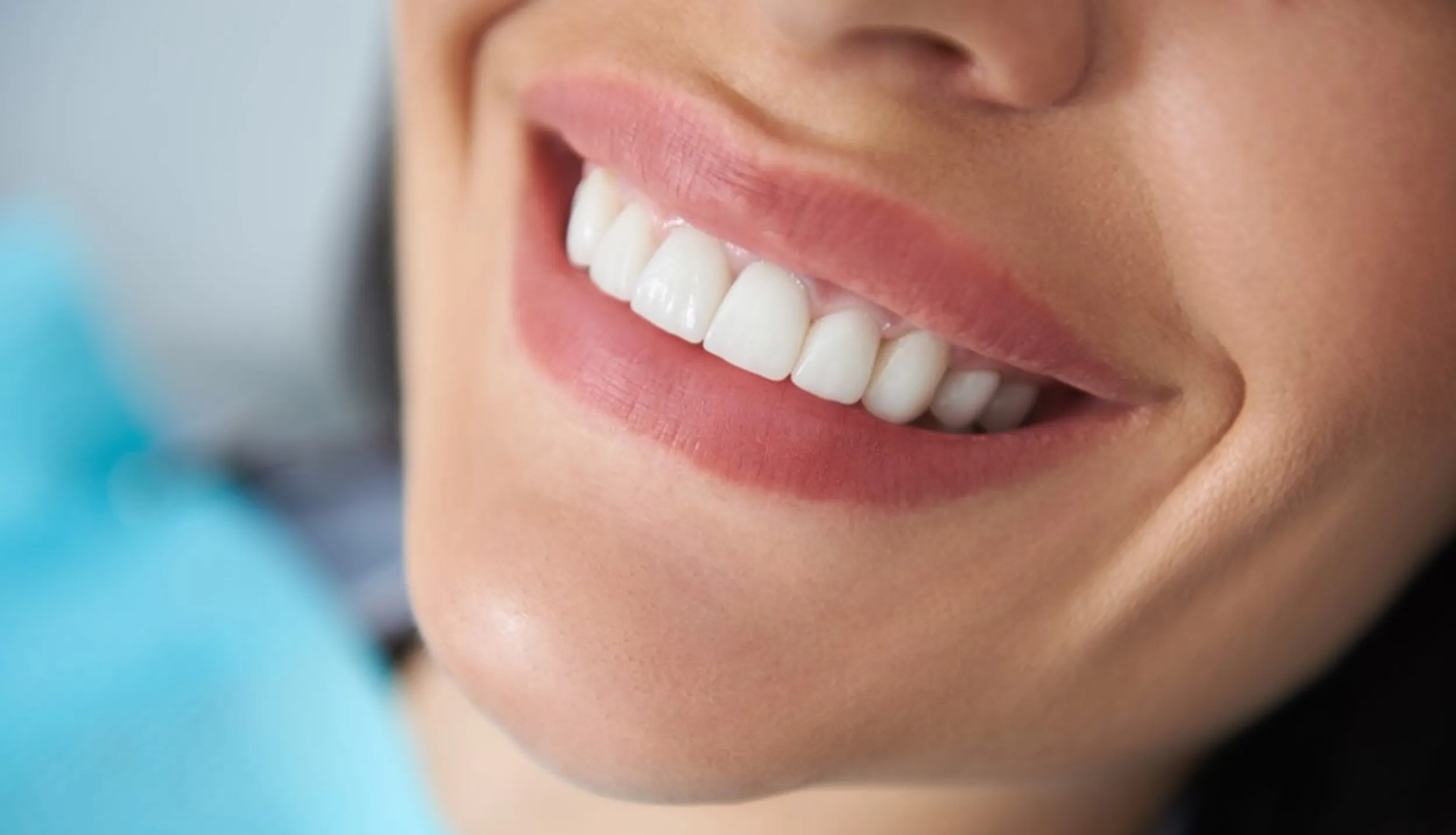 whitening bonded crowns teeth